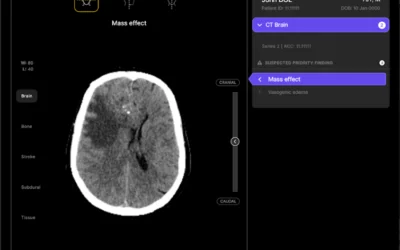 Harrison.ai Secures $112M Series C Funding to Expand Global Footprint and Accelerate Medical AI Innovation Harrison AI.png